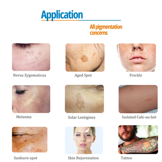 Infographic showing treatment applications for pigmentation concerns, including age spots, freckles, melasma, solar lentigines, café-au-lait spots, sunburn spots, skin rejuvenation, and tattoo removal.