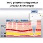 Cartucho de Reemplazo para Máquina HIFU de Elevación Facial 9D