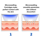 microneedling penetrates skin treatment 