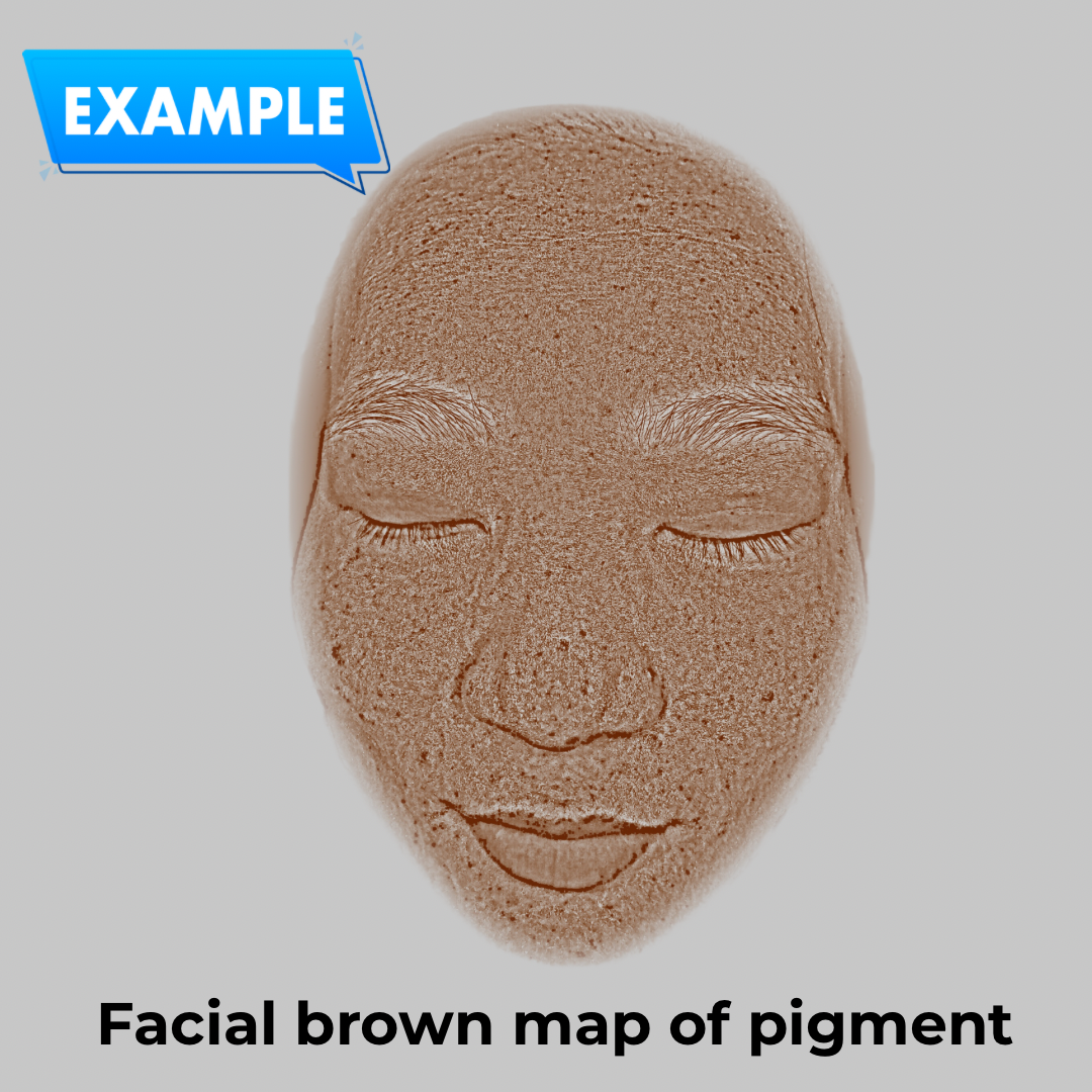 Imagica™ Skin Analyzer & Sharing System