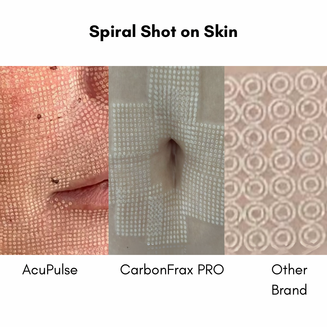 CarbonFrax™  Pro CO2 Fractional Laser