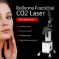 ReDerma™ Fractional CO2 Laser
