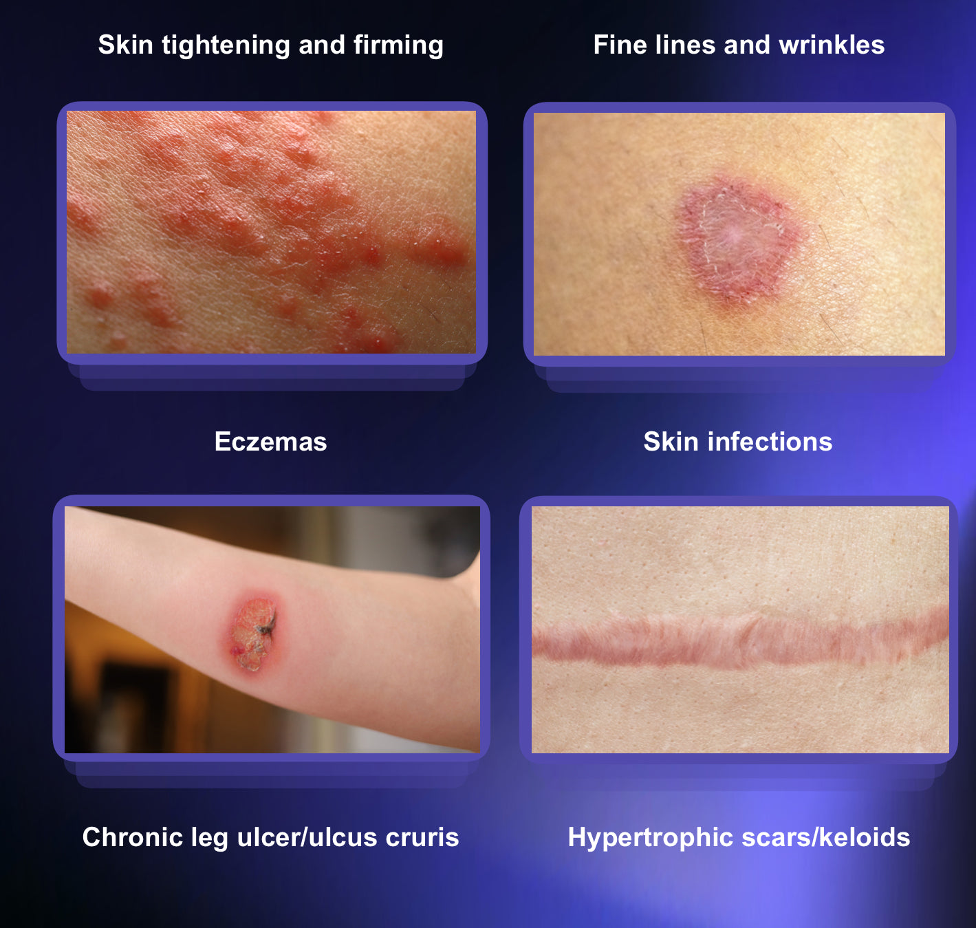 Ionic Beauty 8D - Multifunction Cold & Warm Plasma Machine