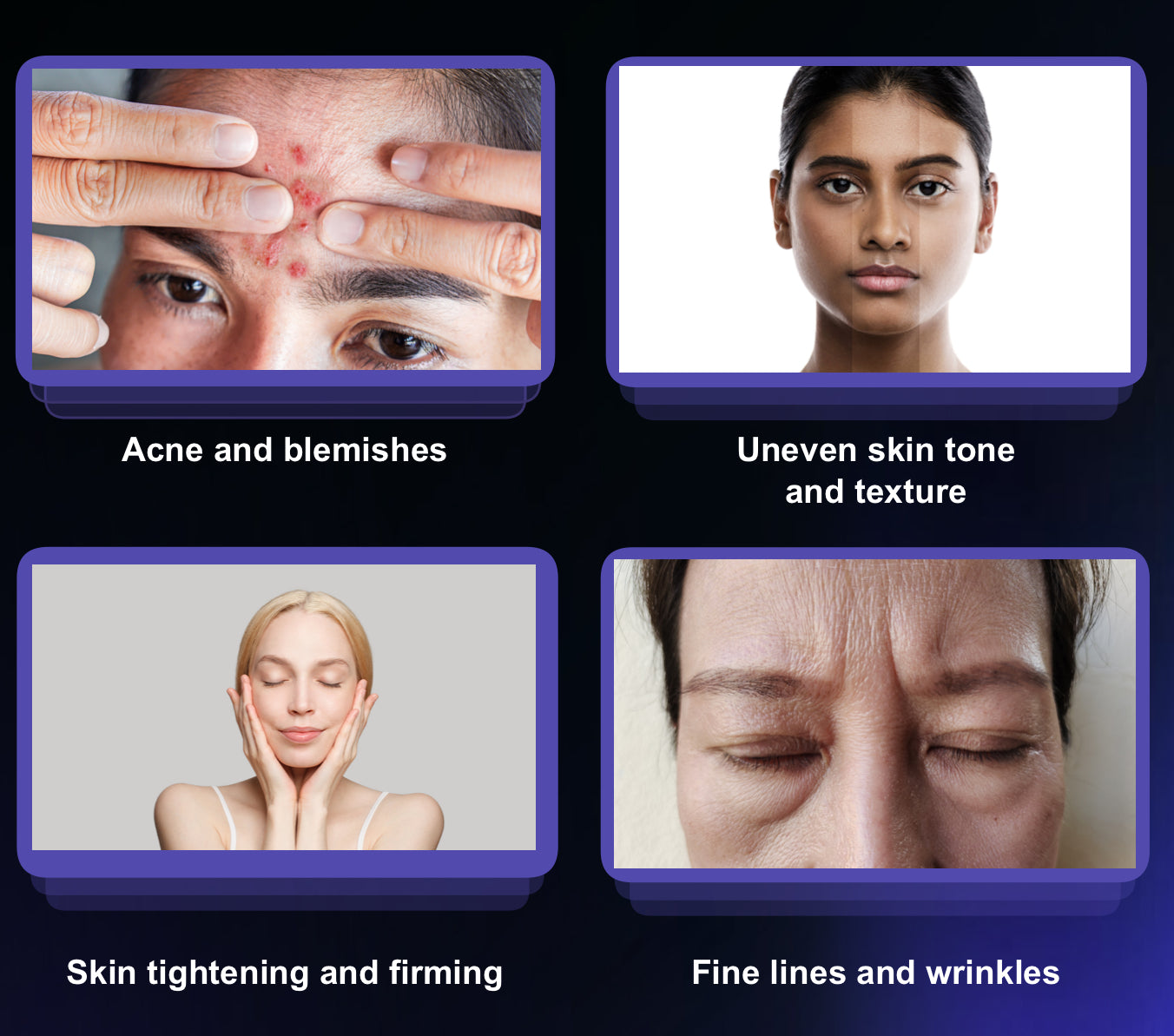 Ionic Beauty 8D - Multifunction Cold & Warm Plasma Machine