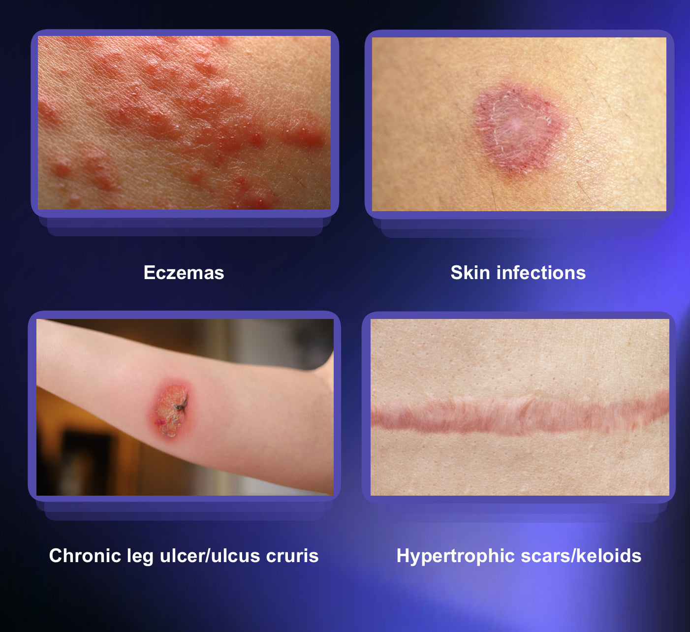 Ionic Beauty 8D - Multifunction Cold & Warm Plasma Machine