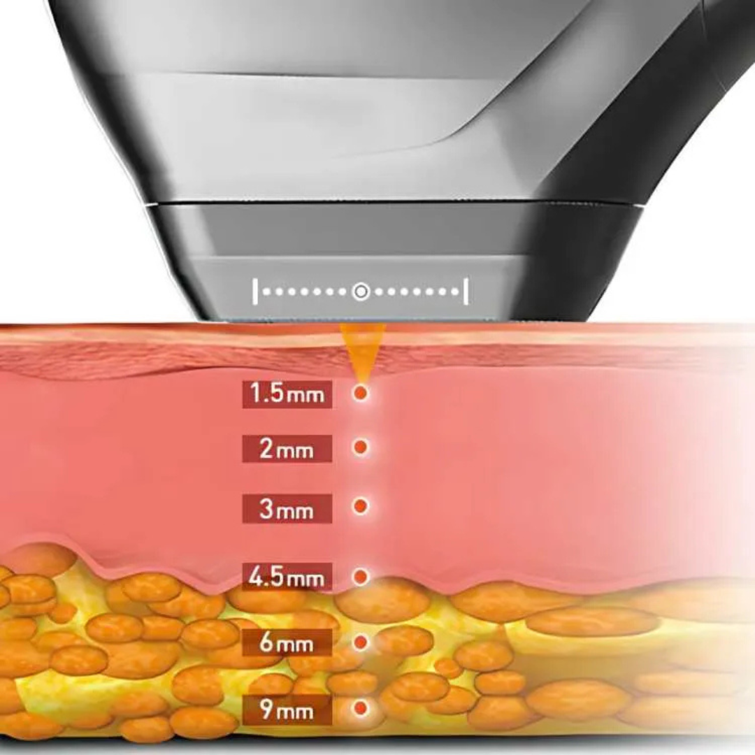 LuminaTight™ 10D HIFU Machine Professional