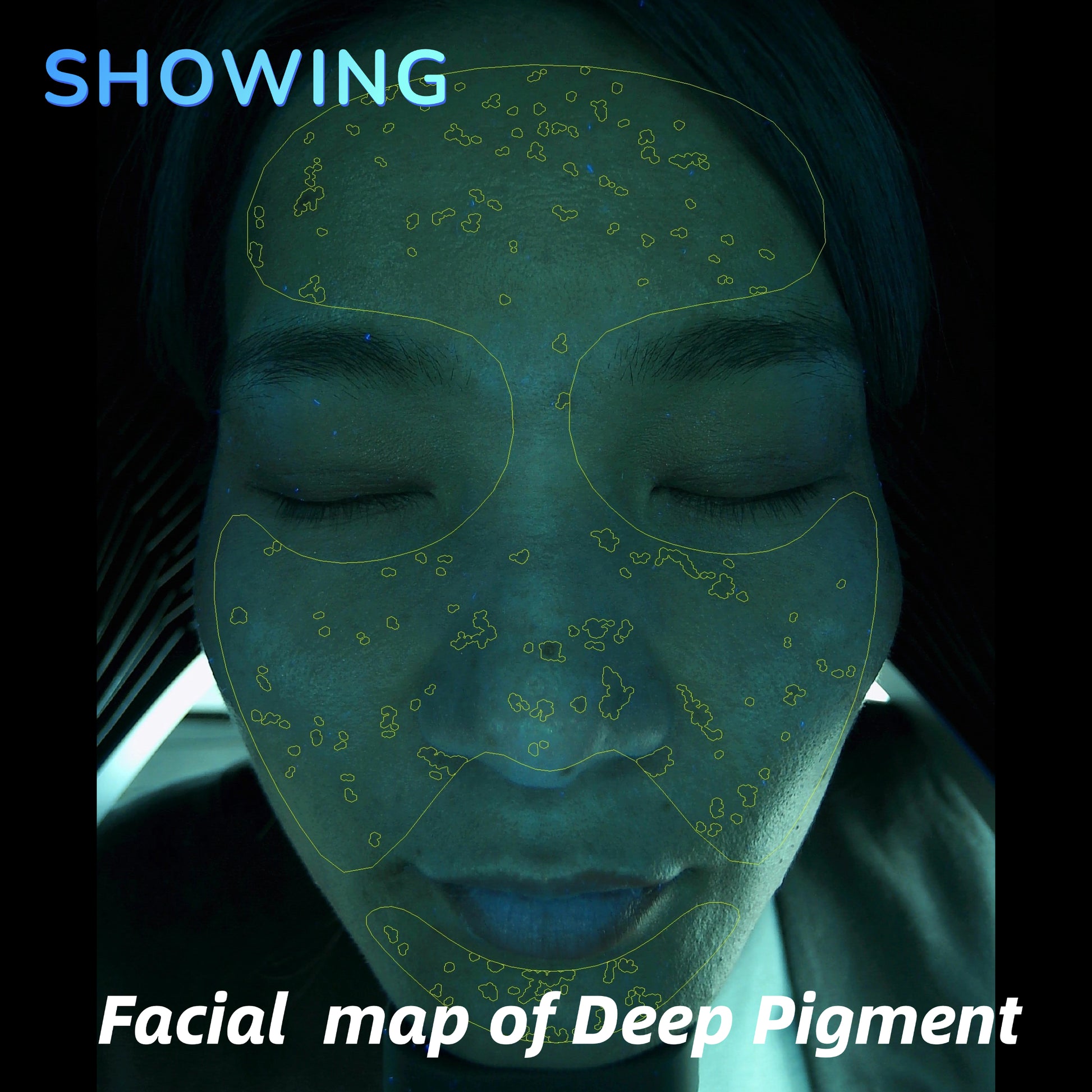 Imagica™ II AI Skin Analysis Machine - 2026 Upgrade