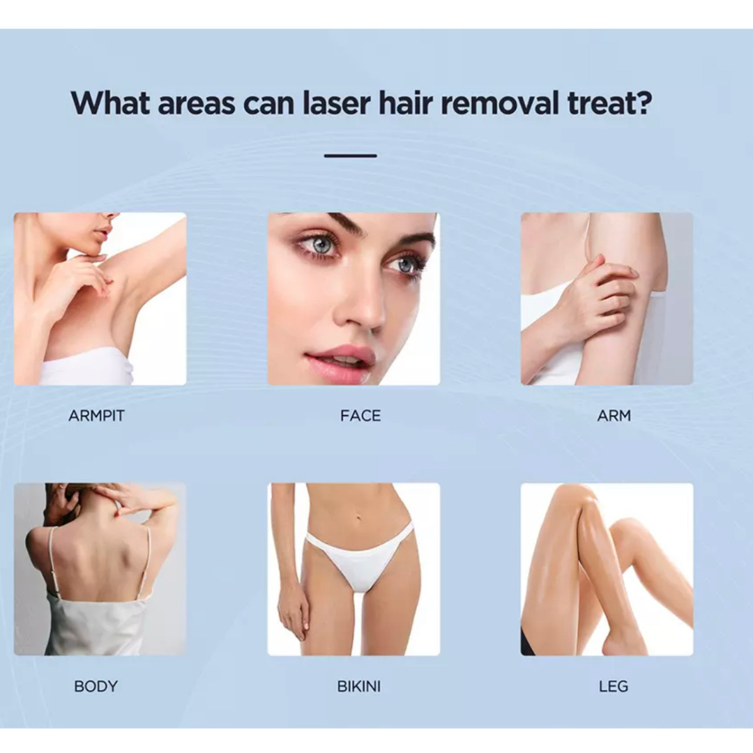 Machine d'épilation laser 4D Athena  