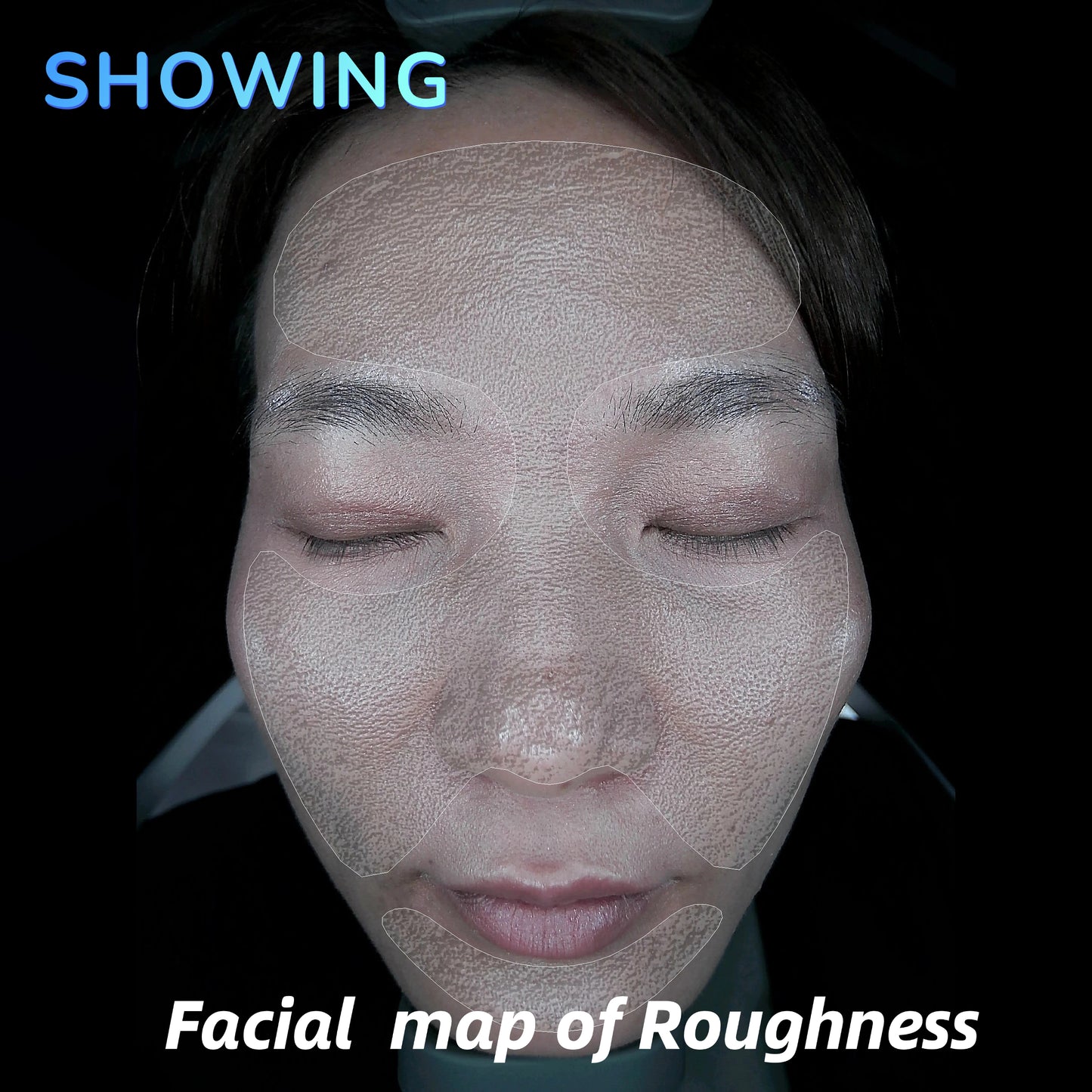 Imagica™ II AI Skin Analysis Machine - 2026 Upgrade