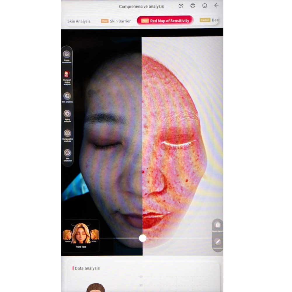 Imagica™ II AI Skin Analysis Machine - 2026 Upgrade