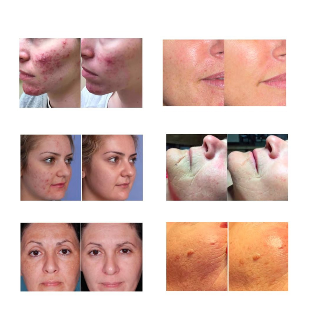 Light Goddess PRO Intensely Therapeutic Skin Revitalizer