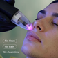 VORTEXPlasm Cold Plasma Device Professional
