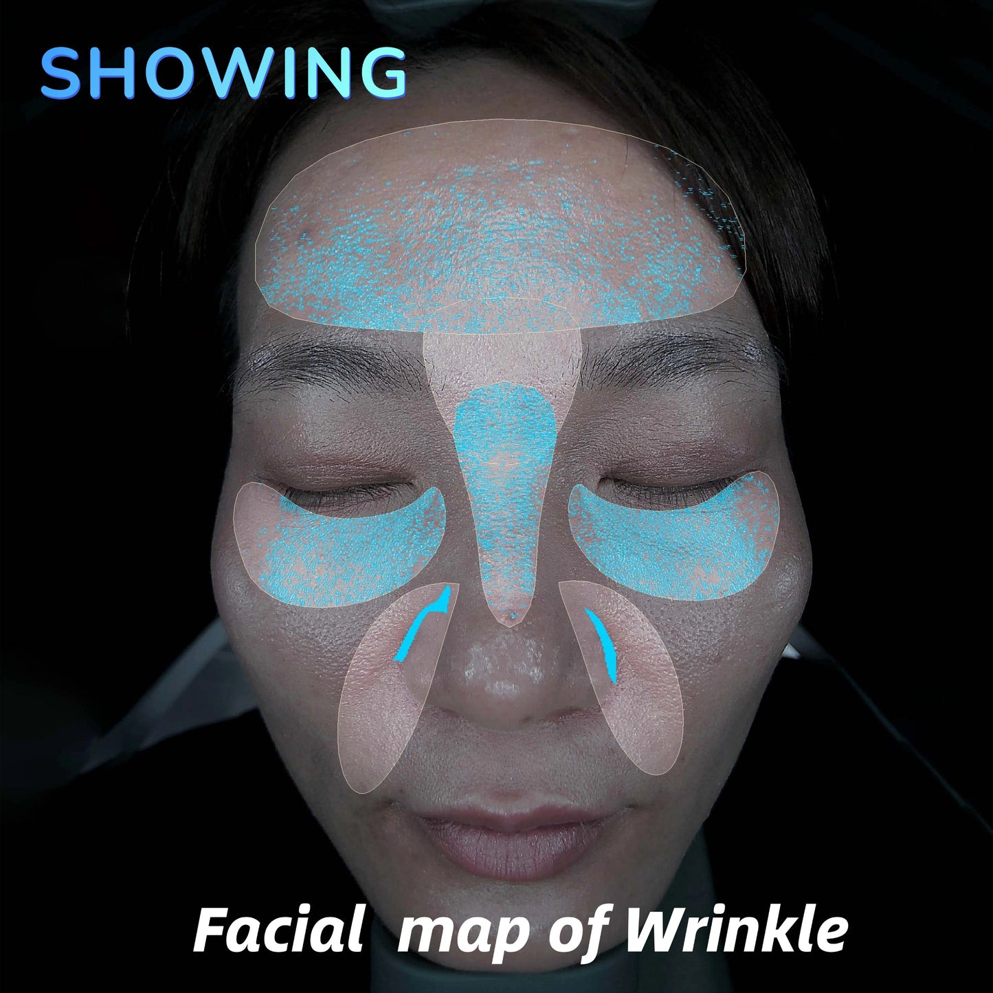 Imagica™ II AI Skin Analysis Machine - 2026 Upgrade